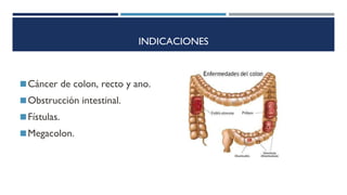 INDICACIONES
◼Cáncer de colon, recto y ano.
◼Obstrucción intestinal.
◼Fístulas.
◼Megacolon.
 