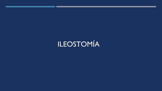 ILEOSTOMÍA
 