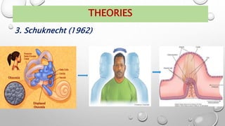 3. Schuknecht (1962)
THEORIES
 