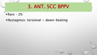 3. ANT. SCC BPPV
Rare – 2%
Nystagmus: torsional + down-beating
 