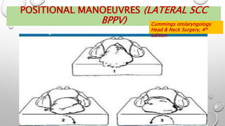 POSITIONAL MANOEUVRES (LATERAL SCC
BPPV) Cummings otolaryngology
Head & Neck Surgery, 4th
edition
 