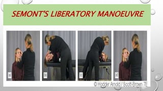 SEMONT'S LIBERATORY MANOEUVRE
 
