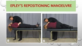 EPLEY’S REPOSITIONING MANOEUVRE
 