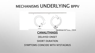 MECHANISMS UNDERLYING BPPV
CANALITHIASIS
DELAYED ONSET
SHORT DURATION
SYMPTOMS COINCIDE WITH NYSTAGMUS
Herdman & Tusa, 2004
 