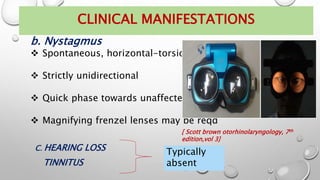C. HEARING LOSS
TINNITUS
Typically
absent
b. Nystagmus
 Spontaneous, horizontal-torsional
 Strictly unidirectional
 Quick phase towards unaffected side
 Magnifying frenzel lenses may be reqd
CLINICAL MANIFESTATIONS
[ Scott brown otorhinolaryngology, 7th
edition,vol 3]
 