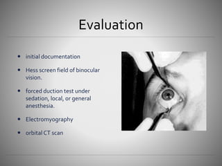 Midfacial fracture | PPTX