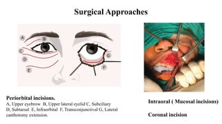 Subciliary Approach Incision zygomatico complex and orbital fracture - brief notes | PPTX