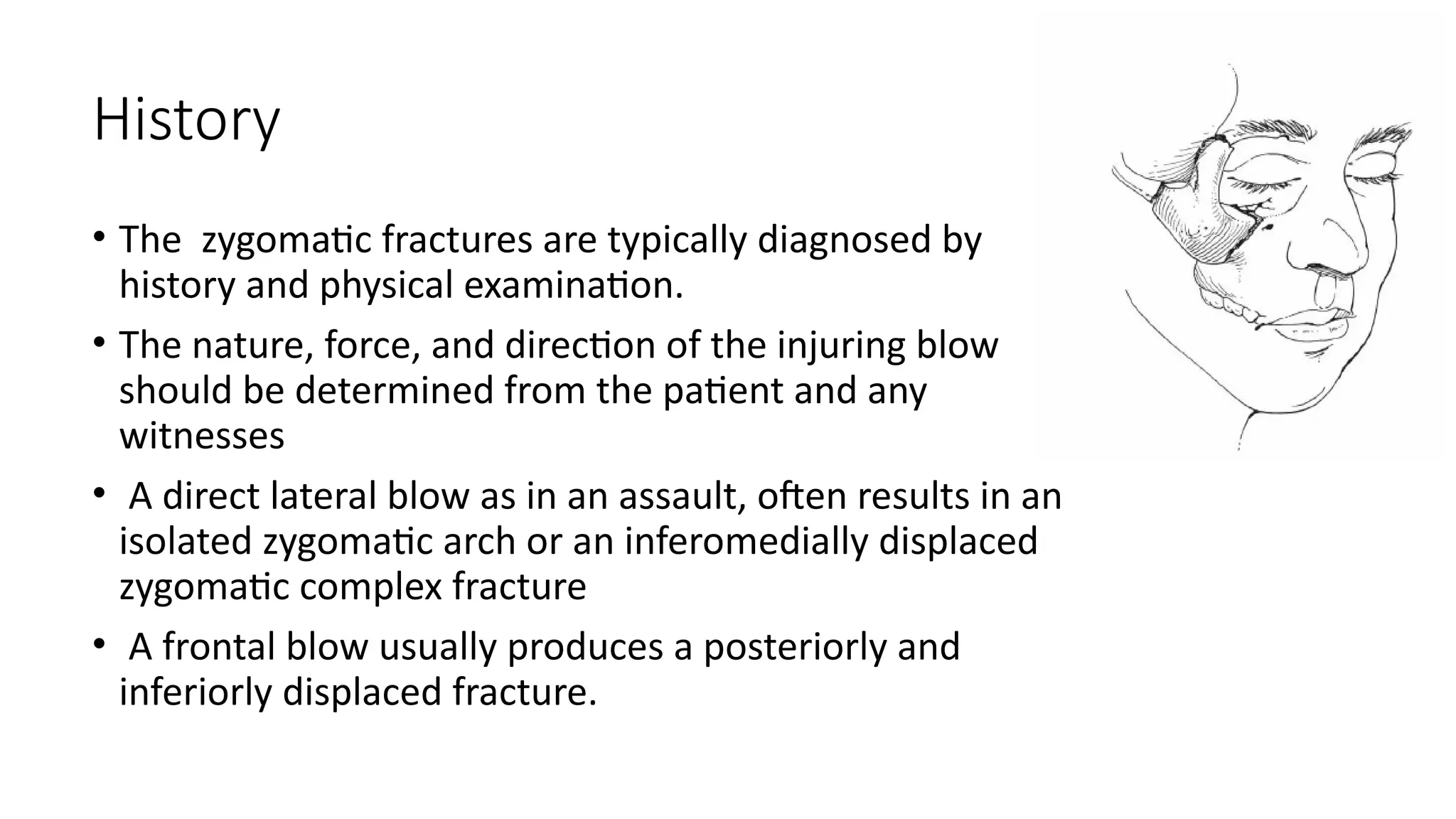 History
• The zygomatic fractures are typically diagnosed by
history and physical examination.
• The nature, force, and direction of the injuring blow
should be determined from the patient and any
witnesses
• A direct lateral blow as in an assault, often results in an
isolated zygomatic arch or an inferomedially displaced
zygomatic complex fracture
• A frontal blow usually produces a posteriorly and
inferiorly displaced fracture.
 