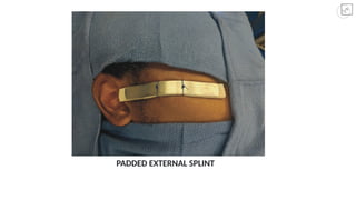 ZMC Fractures in oral and maxillofacial surgery.pptx