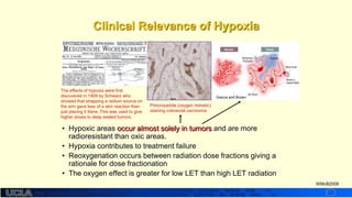 http://dmco.ucla.edu/McBride_Lab
WMcB2008
• Hypoxic areas occur almost solely in tumors and are more
radioresistant than oxic areas.
• Hypoxia contributes to treatment failure
• Reoxygenation occurs between radiation dose fractions giving a
rationale for dose fractionation
• The oxygen effect is greater for low LET than high LET radiation
Giacca and Brown
Pimonizadole (oxygen mimetic)
staining colorectal carcinoma
The effects of hypoxia were first
discovered in 1909 by Schwarz who
showed that strapping a radium source on
the arm gave less of a skin reaction than
just placing it there. This was used to give
higher doses to deep seated tumors.
Clinical Relevance of Hypoxia
 