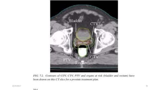 22/3/2017 Dr. Nik Noor Ashikin Bt Nik Ab Razak 35
 