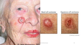 22/3/2017 Dr. Nik Noor Ashikin Bt Nik Ab Razak 47
 