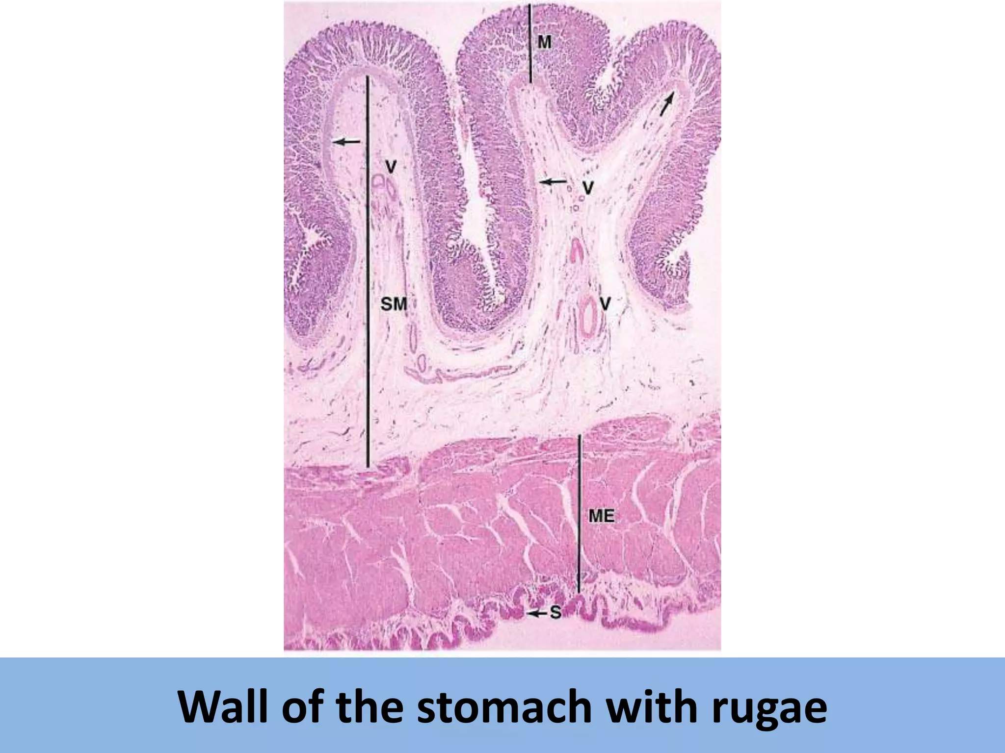 Histological features of gastrointestinal tract with clinical ...