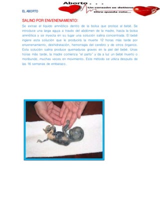 SALINO POR ENVENENAMIENTO:
Se extrae el líquido amniótico dentro de la bolsa que proteje al bebé. Se
introduce una larga aguja a través del abdómen de la madre, hasta la bolsa
amniótica y se inyecta en su lugar una solución salina concentrada. El bebé
ingiere esta solución que le producirá la muerte 12 horas más tarde por
envenenamiento, deshidratación, hemorragia del cerebro y de otros órganos.
Esta solución salina produce quemaduras graves en la piel del bebé. Unas
horas más tarde, la madre comienza "el parto" y da a luz un bebé muerto o
moribundo, muchas veces en movimiento. Este método se utiliza después de
las 16 semanas de embarazo.
 