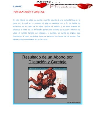 POR DILATACIÓN Y CURETAJE
En este método se utiliza una cureta o cuchillo provisto de una cucharilla filosa en la
punta con la cual se va cortando al bebé en pedazos con el fin de facilitar su
extracción por el cuello de la matriz. Durante el segundo y el tercer trimestre del
embarazo el bebé es ya demasiado grande para extraerlo por succión; entonces se
utiliza el método llamado por dilatación y curetaje. La cureta se emplea para
desmembrar al bebé, sacándose luego en pedazos con ayuda de los forceps. Este
método está convirtiéndose en el más usual.
 