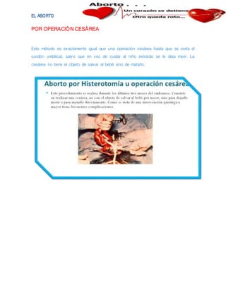 POR OPERACIÓN CESÁREA
Este método es exactamente igual que una operación cesárea hasta que se corta el
cordón umbilical, salvo que en vez de cuidar al niño extraído se le deja morir. La
cesárea no tiene el objeto de salvar al bebé sino de matarlo.
 