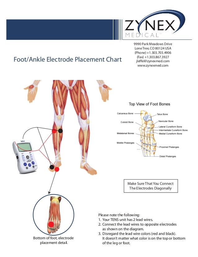 Tens Pad Placement Chart