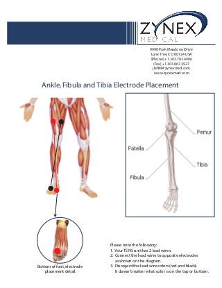 9990 Park Meadows Drive
Lone Tree,CO 80124 USA
(Phone) +1.303.703.4906
(Fax) +1.303.867.3927
jleffel@zynexmed.com
www.zynexmed.com
Please note the following:
1. Your TENS unit has 2 lead wires.
2. Connect the lead wires to opposite electrodes
as shown on the diagram.
3. Disregard the lead wire colors (red and black).
It doesn’t matter what color is on the top or bottom.
Ankle,Fibula and Tibia Electrode Placement
Bottom of foot,electrode
placement detail.
 