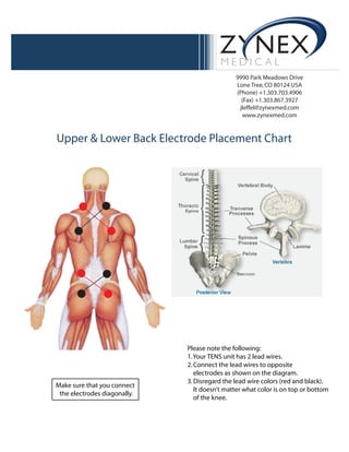 9990 Park Meadows Drive
Lone Tree,CO 80124 USA
(Phone) +1.303.703.4906
(Fax) +1.303.867.3927
jleffel@zynexmed.com
www.zynexmed.com
Upper & Lower Back Electrode Placement Chart
Please note the following:
1.Your TENS unit has 2 lead wires.
2.Connect the lead wires to opposite
electrodes as shown on the diagram.
3.Disregard the lead wire colors (red and black).
It doesn’t matter what color is on top or bottom
of the knee.
Make sure that you connect
the electrodes diagonally.
 