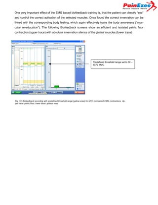 One very important effect of the EMG based biofeedback-training is, that the patient can directly “see”
and control the correct activation of the selected muscles. Once found the correct innervation can be
linked with the corresponding body feeling, which again effectively trains the body awareness (“muscular re-education”). The following Biofeedback screens show an efficient and isolated pelvic floor
contraction (upper trace) with absolute innervation silence of the gluteal muscles (lower trace)

Predefined threshold range set to 30 –
50 % MVC

Fig. 10: Biofeedback recording with predefined threshold range (yellow area) for MVC normalized EMG contractions. Upper trace: pelvic floor, lower trace: gluteus max.

 