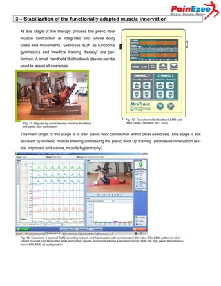 3 – Stabilization of the functionally adapted muscle innervation
At this stage of the therapy process the pelvic floor
muscle contraction is integrated into whole body
tasks and movements. Exercises such as functional
gymnastics and “medical training therapy” are performed. A small handheld Biofeedback device can be
used to assist all exercises.

Fig. 11: Regular leg press training machine facilitates
the pelvic floor contraction

Fig. 12: Two channel biofeedback EMG unit
(MyoTrace – Noraxon INC. USA)

The main target of this stage is to train pelvic floor contraction within other exercises. This stage is still
assisted by isolated muscle training addressing the pelvic floor Up training (increased innervation levels, improved endurance, muscle hypertrophy).

Fig. 13: Telemetric 8 channel EMG recording of trunk and hip muscles with synchronized DV video. The EMG pattern of all involved muscles can be studied while performing regular abdominal training exercise (crunch). Note the high pelvic floor innervation > 50% MVC at peak position.

 