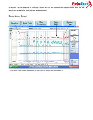 All signals can be observed in real time, stored records are shown in the record viewer and the test
results are analyzed in an automatic analysis report:
Record Viewer Screen:

Baseline

Quick Flicks

Max.
Contraction

Static
Hold

Fig. 6: Record Viewer showing all activities of the multi activity test protocol within MyoResearch XP

Resting
Tone

 