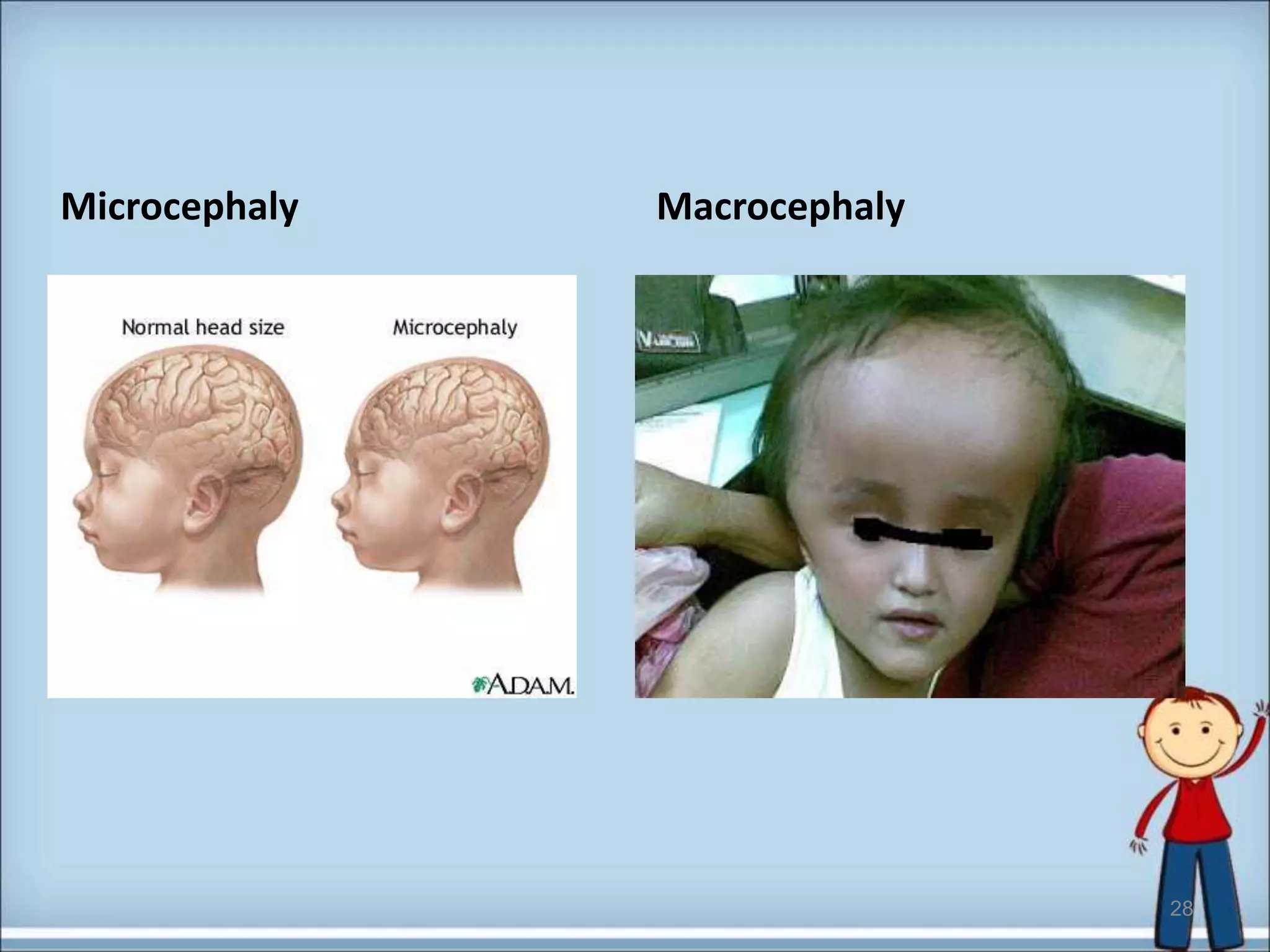 Paediatric Anthropometry | PPTX