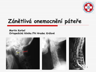 1
Zánětlivá onemocnění páteře
Martin Korbel
Ortopedická klinika FN Hradec Králové
 