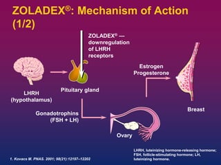 ZOLADEX®: Mechanism of Action
(1/2)
LHRH
(hypothalamus)
Pituitary gland
Estrogen
Progesterone
Ovary
ZOLADEX® —
downregulation
of LHRH
receptors
Gonadotrophins
(FSH + LH)
Breast
LHRH, luteinizing hormone-releasing hormone;
FSH, follicle-stimulating hormone; LH,
luteinizing hormone.1. Kovacs M. PNAS. 2001; 98(21):12197–12202
 