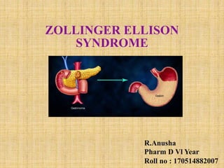 ZOLLINGER ELLISON
SYNDROME
R.Anusha
Pharm D Vl Year
Roll no : 170514882007
 