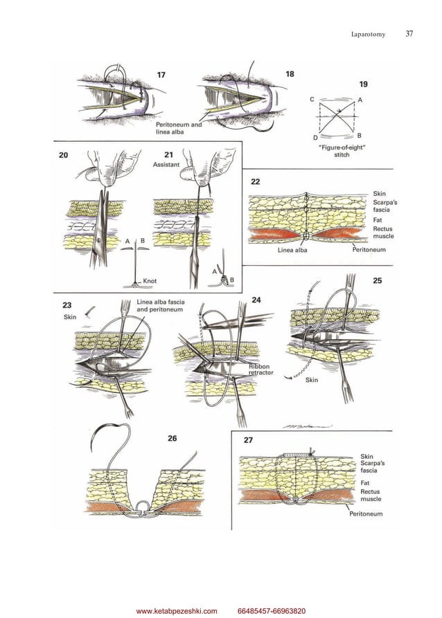 Zollinger’s Atlas of Surgical Operations-McGraw-Hill (2016).pdf