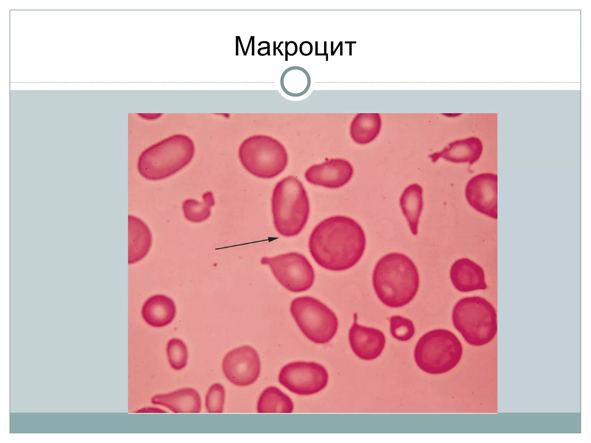 Макроцит
 