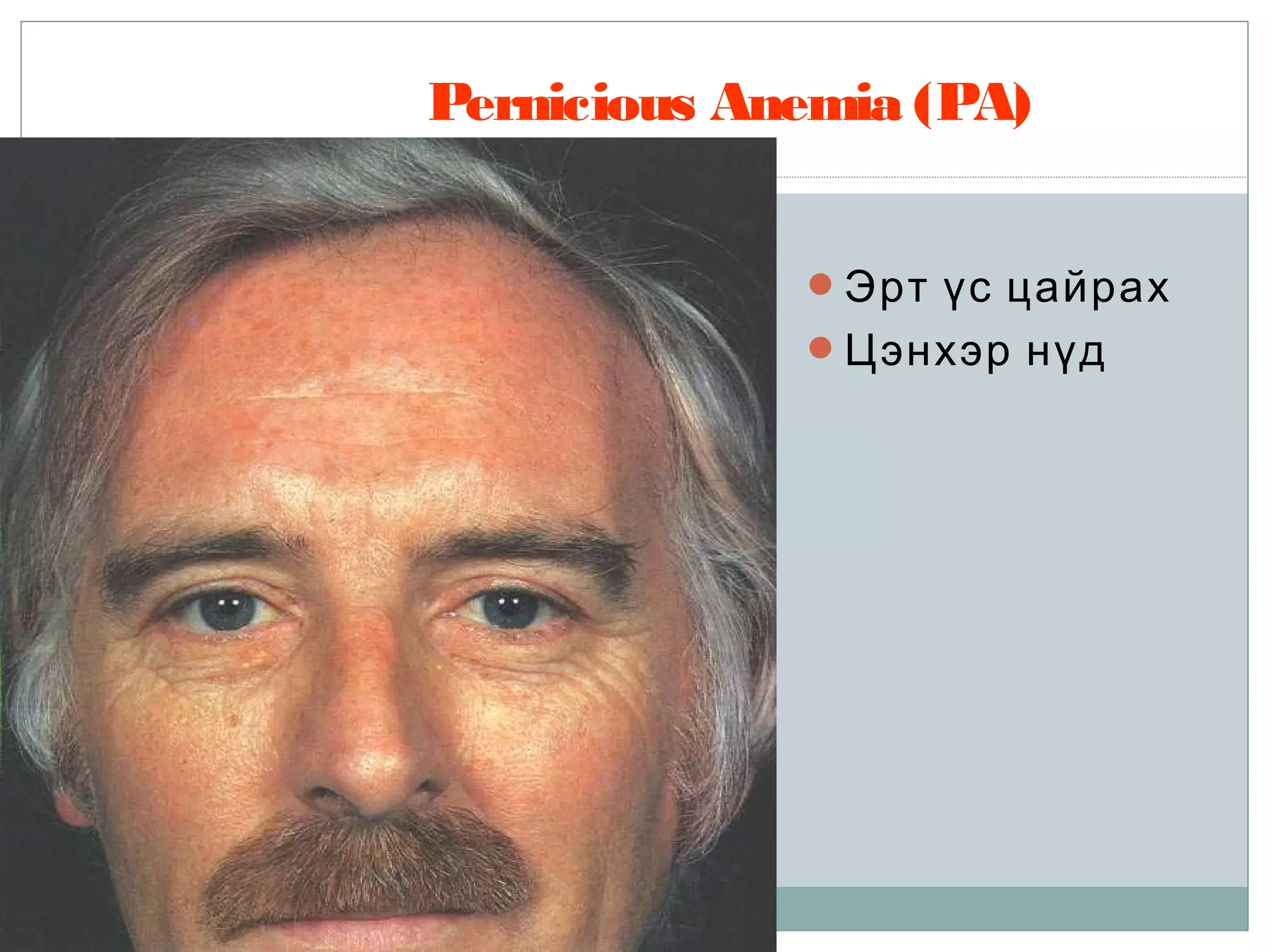 B12 фолийн хүчлийн дутагдлын анеми ppt | PPT