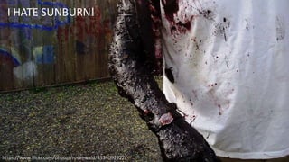 21
https://www.flickr.com/photos/rosenwald/4534092922/
I HATE SUNBURN!
 