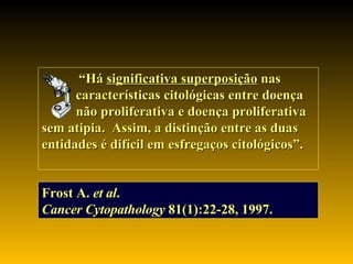 “ Há  significativa superposição  nas características citológicas entre doença não proliferativa e doença proliferativa sem atipia.  Assim, a distinção entre as duas entidades é difícil em esfregaços citológicos”.  Frost A.  et al .   Cancer Cytopathology  81(1):22-28, 1997. 