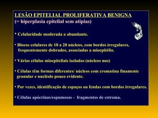LESÃO EPITELIAL PROLIFERATIVA BENIGNA   (= hiperplasia epitelial sem atipias) Celularidade moderada a abundante. Blocos celulares de 10 a 20 núcleos, com bordos irregulares, frequentemente dobrados, associadas a mioepitélio. Várias células mioepiteliais isoladas (núcleos nus) Células têm formas diferentes/ núcleos com cromatina finamente granular e nucléolo pouco evidente. Por vezes, identificação de espaços ou fendas com bordos irregulares. Células apócrinas/espumosas -  fragmentos de estroma. 