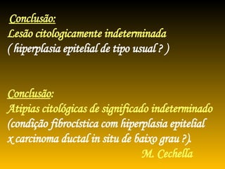 Conclusão:   Lesão citologicamente indeterminada  ( hiperplasia epitelial de tipo usual ? )   Conclusão :  Atipias citológicas de significado indeterminado (condição fibrocística com hiperplasia epitelial x carcinoma ductal in situ de baixo grau ?).   M. Cechella 