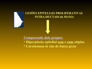 LESÕES EPITELIAIS PROLIFERATIVAS   INTRA-DUCTAIS da MAMA Compreende dois grupos: Hiperplasia epitelial  sem  e  com  atipias Carcinomas  in situ  de baixo grau 