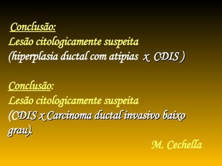 Conclusão:   Lesão citologicamente suspeita  (hiperplasia ductal com atipias  x  CDIS ) Conclusão :  Lesão citologicamente suspeita (C DIS x Carcinoma ductal invasivo baixo grau).     M. Cechella 