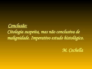Conclusão:   Citologia suspeita, mas não conclusiva de malignidade. Imperativo estudo histológico.   M. Cechella 