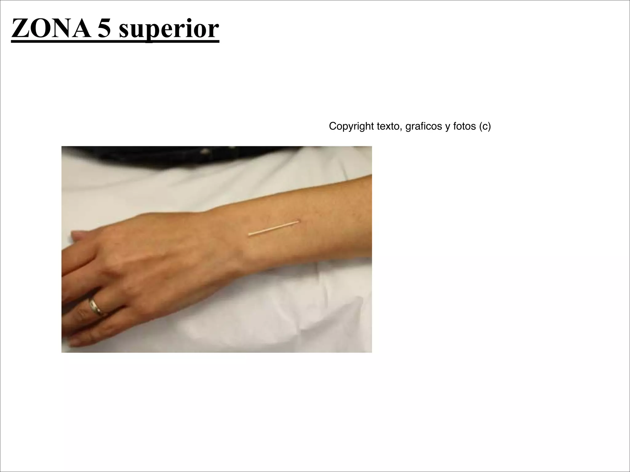 ZONA 5 superior


                  Copyright texto, graﬁcos y fotos (c)
 