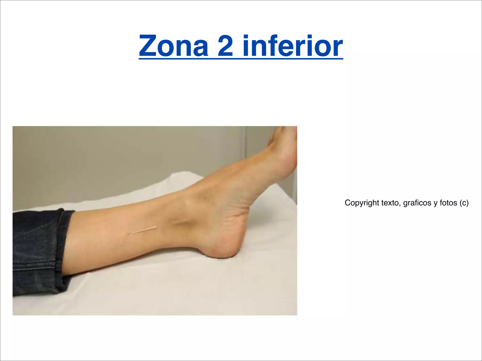 Zona 2 inferior




                  Copyright texto, graﬁcos y fotos (c)
 