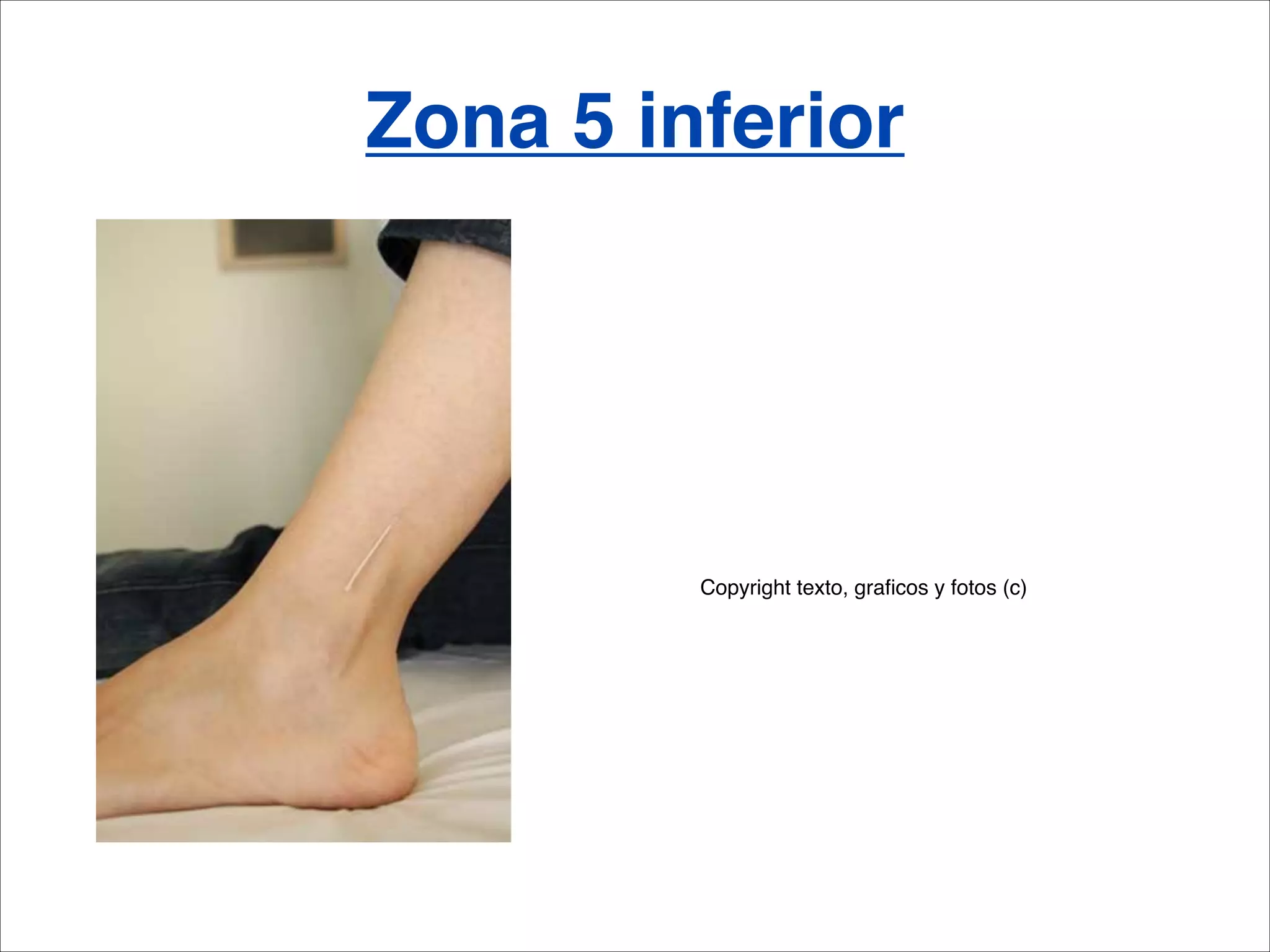 Zona 5 inferior




         Copyright texto, graﬁcos y fotos (c)
 