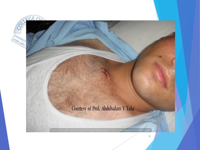 Zone I Neck Stab Wound with a Normal Aortography.pdf