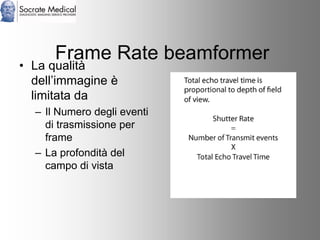 Socrate Medical presenta Zone Sonography, by Zonare