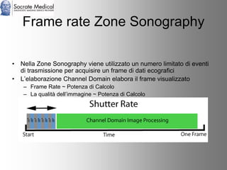 Socrate Medical presenta Zone Sonography, by Zonare