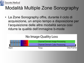 Socrate Medical presenta Zone Sonography, by Zonare