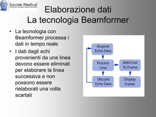 Socrate Medical presenta Zone Sonography, by Zonare