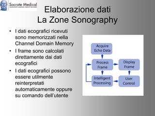 Socrate Medical presenta Zone Sonography, by Zonare