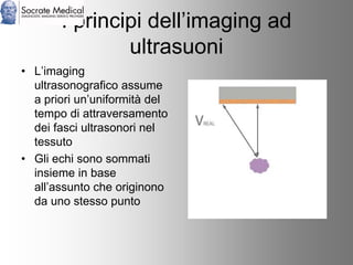 Socrate Medical presenta Zone Sonography, by Zonare
